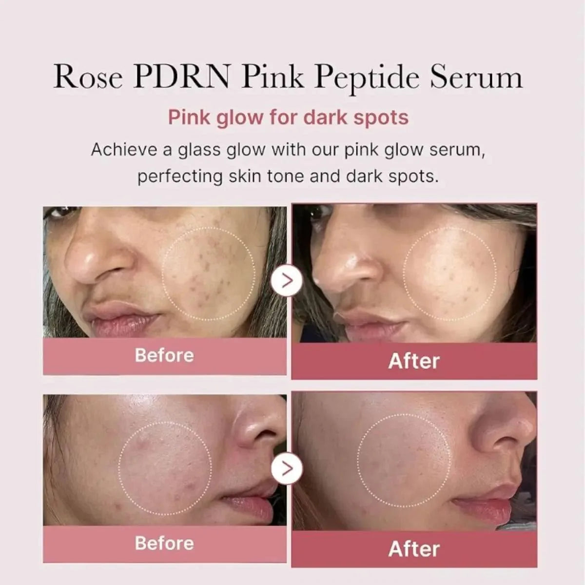PDRN Pink Peptide Serum